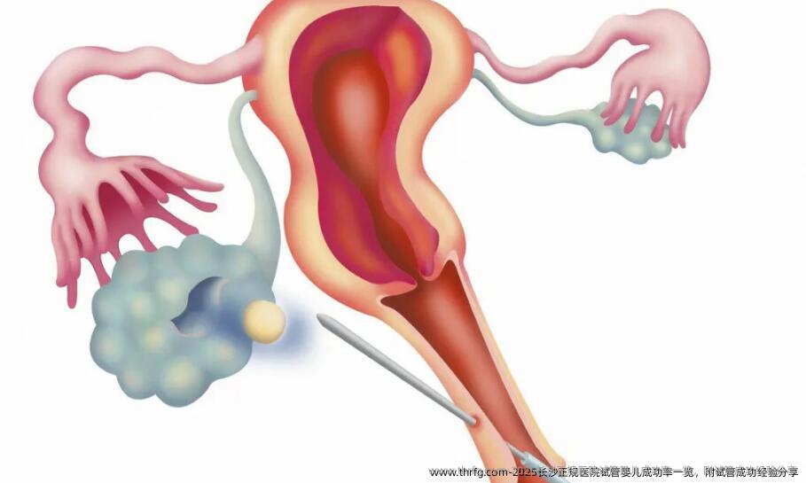 2025长沙正规医院试管婴儿成功率一览，附试管成功经验分享