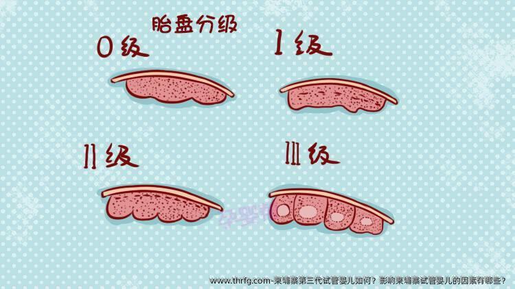 柬埔寨第三代试管婴儿如何？影响柬埔寨试管婴儿的因素有哪些？