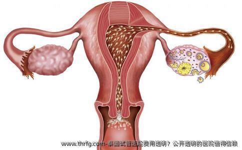 泰国试管医院费用透明？公开透明的医院值得信赖