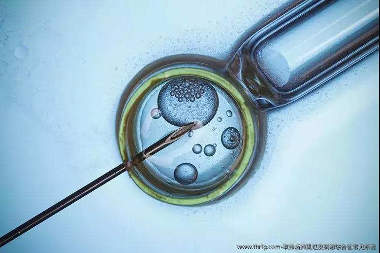 卵泡取出后卵巢过度刺激综合征常见原因