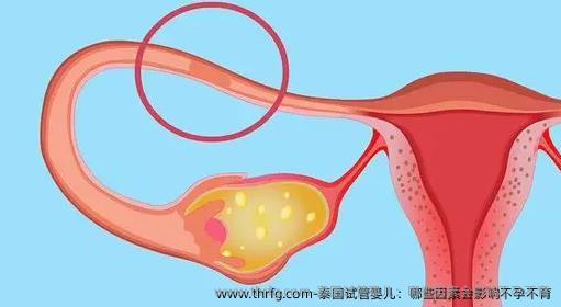 泰国试管婴儿：哪些因素会影响不孕不育