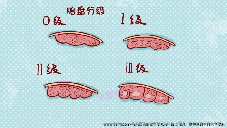 马来西亚做试管婴儿有年龄上限吗，高龄生育有何条件要求