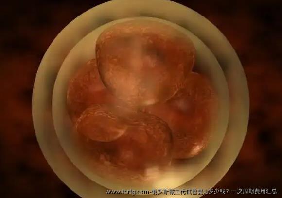 俄罗斯做三代试管婴儿多少钱？一次周期费用汇总
