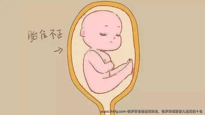 俄罗斯生殖医院排名，俄罗斯试管婴儿医院前十名