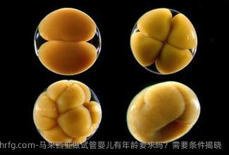 马来西亚做试管婴儿有年龄要求吗？需要条件揭晓