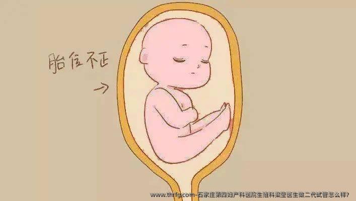 石家庄第四妇产科医院生殖科梁莹医生做二代试管怎么样？