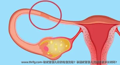 做试管婴儿前的检查流程？泰国试管婴儿流程需要多长时间？