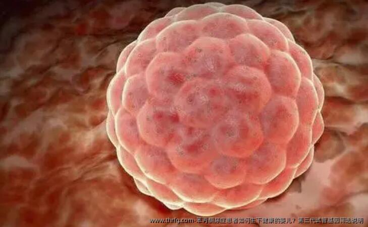 苯丙酮尿症患者如何生下健康的婴儿？第三代试管基因筛选说明