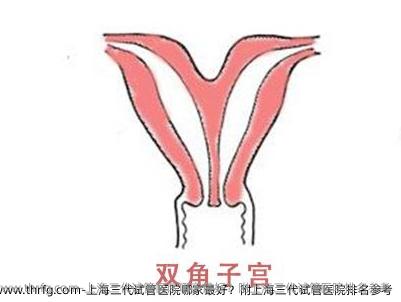 上海三代试管医院哪家较好？附上海三代试管医院排名参考