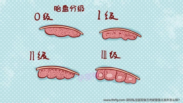 深圳私立医院做三代试管婴儿技术怎么样？