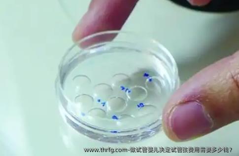做试管婴儿决定试管孩费用需要多少钱？