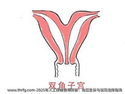2025年人工授精费用详解：地区差异与医院选择指南