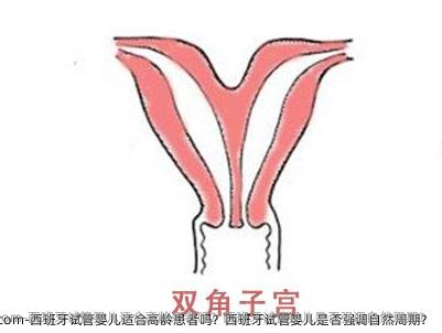西班牙试管婴儿适合高龄患者吗？西班牙试管婴儿是否强调自然周期？