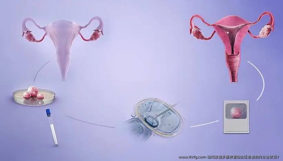 如何改善多囊卵巢综合征患者的内分泌状况？