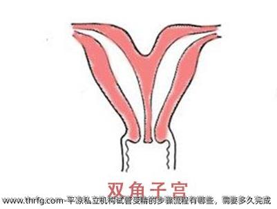 平凉私立机构试管受精的步骤流程有哪些，需要多久完成