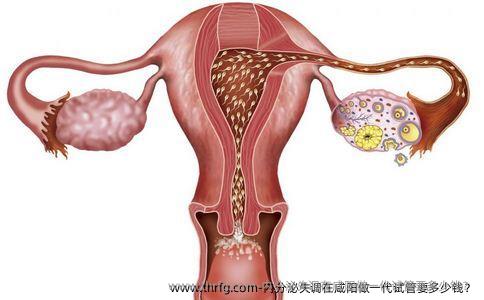 内分泌失调在咸阳做一代试管要多少钱？