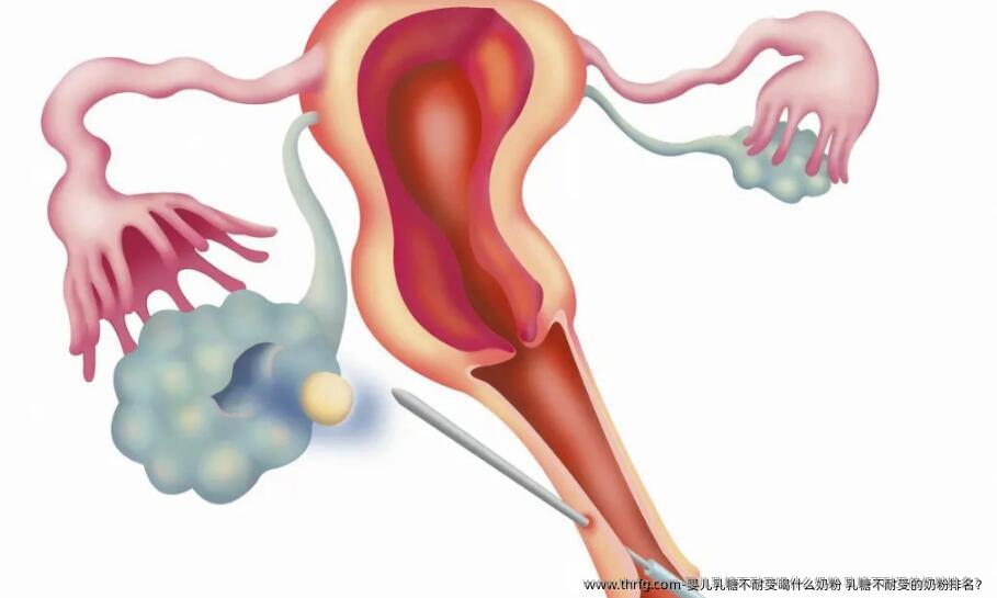 婴儿乳糖不耐受喝什么奶粉？乳糖不耐受的奶粉排名？