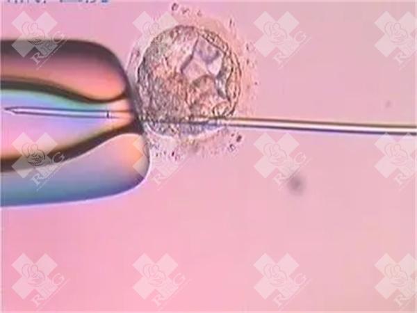 2025福建省妇幼三代试管婴儿费用一览，附试管婴儿成功率介绍